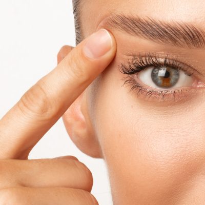 Blepharoplasty. Woman with unusual eye color touching eyelid skin and pointing to the wrinkles on the upper eyelid, closeup shot